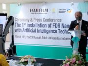FUJIFILM Hadirkan Instalasi Mobile Digital X-Ray Berteknologi AI di RSUI Mobile Digital X-Ray